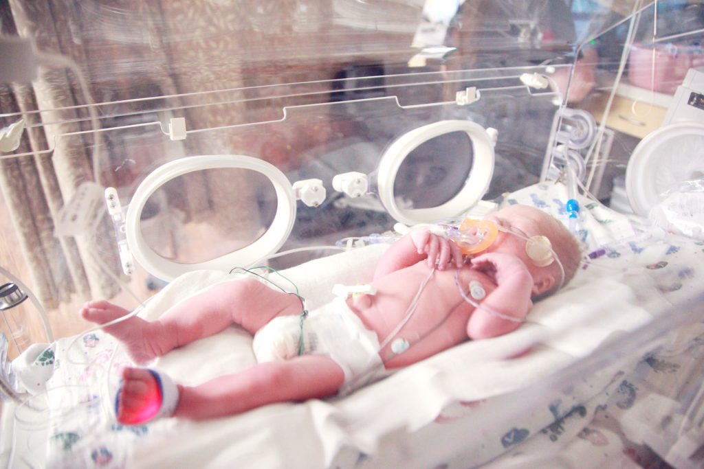 baby lying in incubator
